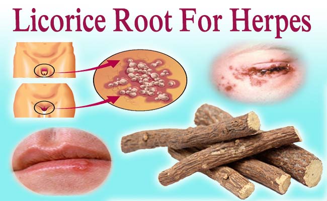 licorice-root-for-herpes