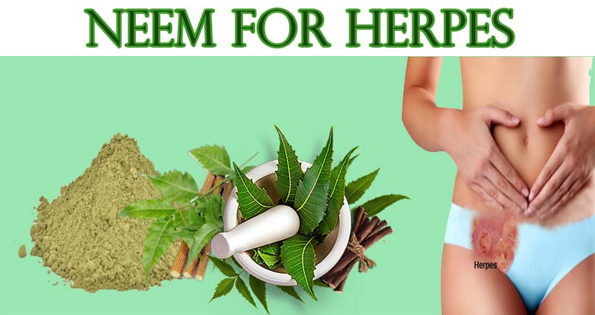 Neem the most potent treatment for herpes - Herpes Cure