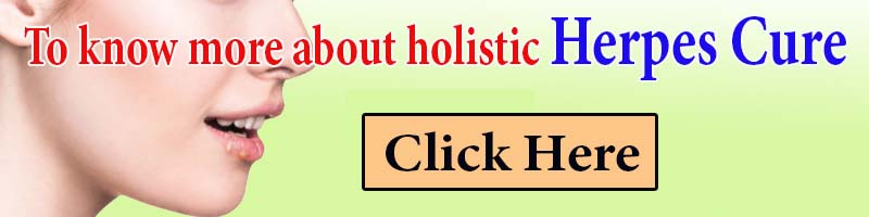 holistic herpes cure