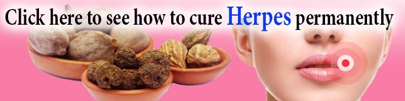 cure herpes permanently