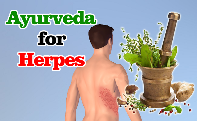 ayurveda-for-herpes