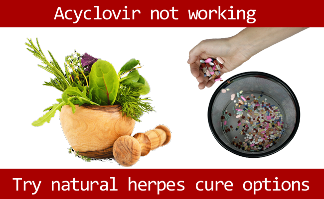 natural herpes cure options