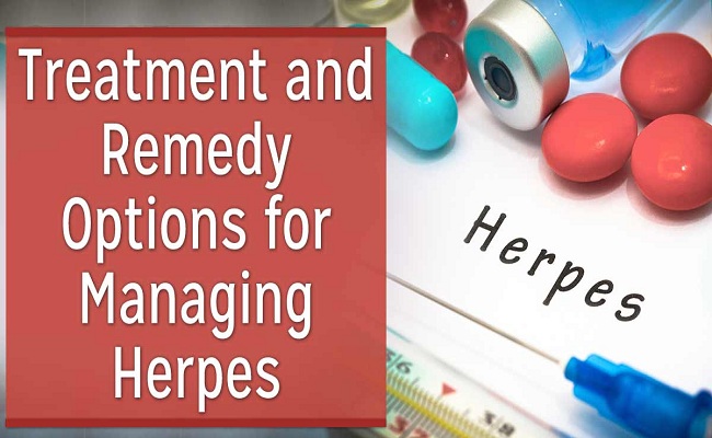 treatment-herpes