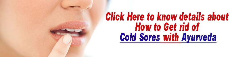 how to get rid of cold sores with Ayurveda